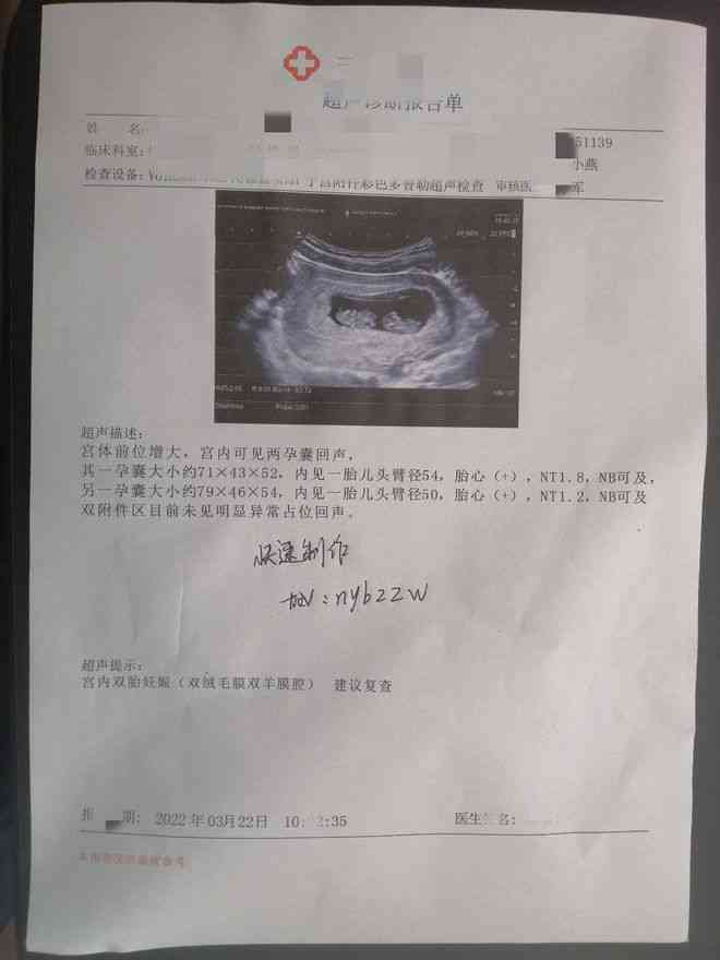 磁共振一般报告多久出来：检查后多久可取报告单及检测结果时长说明