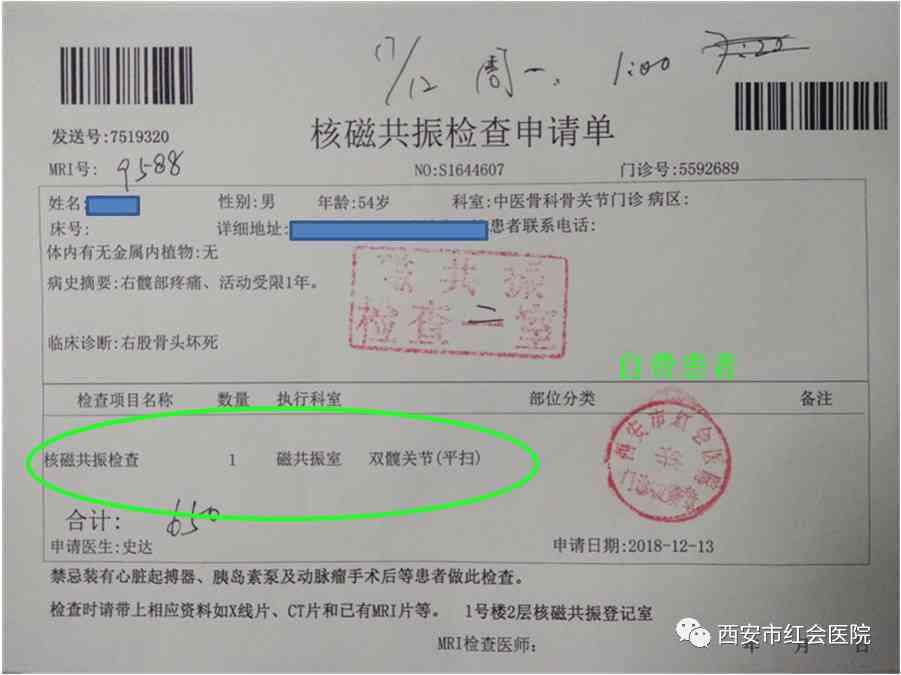 磁共振检查后报告领取时间解析：涵不同医院、病情与流程详解