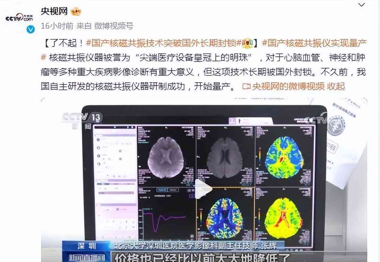 ai看磁共振报告多久出来