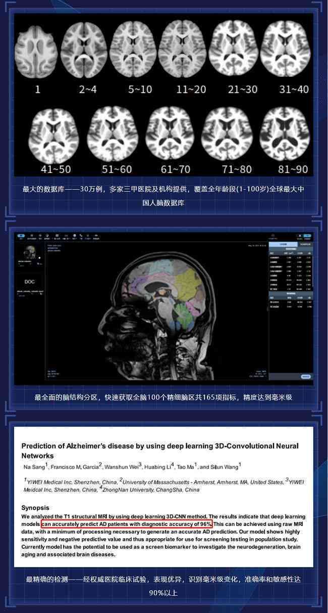 ai看磁共振报告多久出来