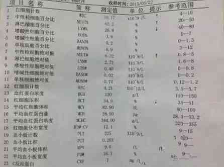ai看血常规报告怎么看结果及血型，在线解读血常规报告单