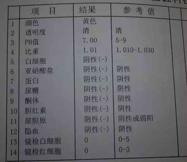 ai看血常规报告怎么看结果及血型，在线解读血常规报告单