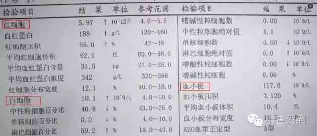 全面解读血常规报告单：AI助您深入了解白细胞、红细胞、血小板指标异常