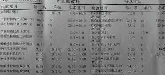 血常规检验报告单解读指南：全面解析各项指标与常见问题解答