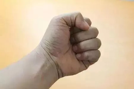 运动中手指脱臼：打球时遭遇脱臼的应急处理与复指南