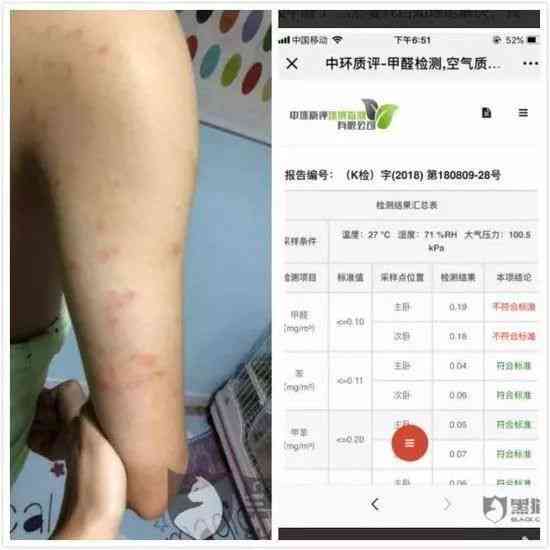 打球脱臼认定工伤标准最新是多少