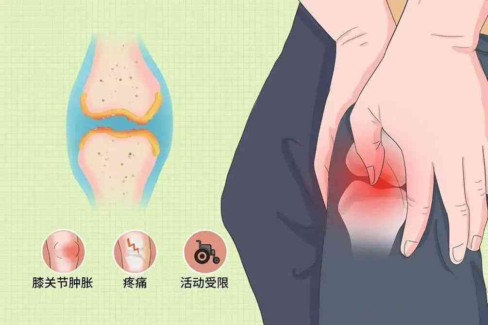 膝关节扭伤引发膜炎：有效治疗方法与治愈可能性探讨