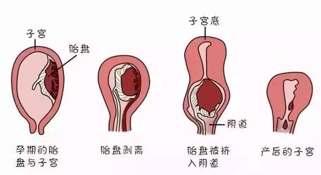 扭伤引起的膜炎多久能彻底恢复，正常走路需几时？