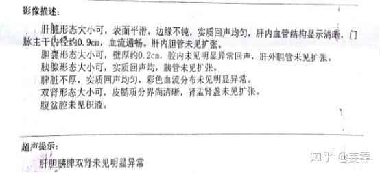 扭伤腰怎么认定工伤的等级及标准判定
