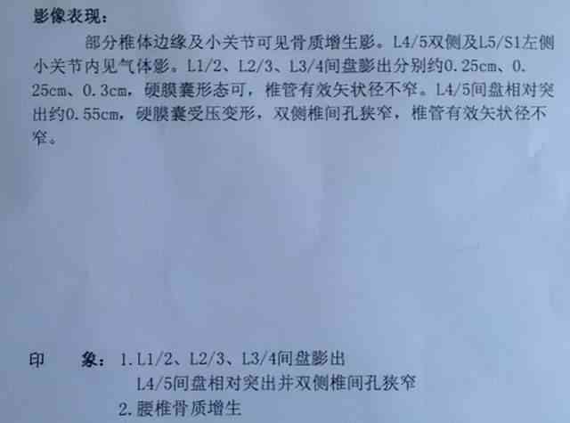 腰扭伤检查出椎间盘突出能鉴定工伤等级吗，工伤认定及劳动能力鉴定条件探讨
