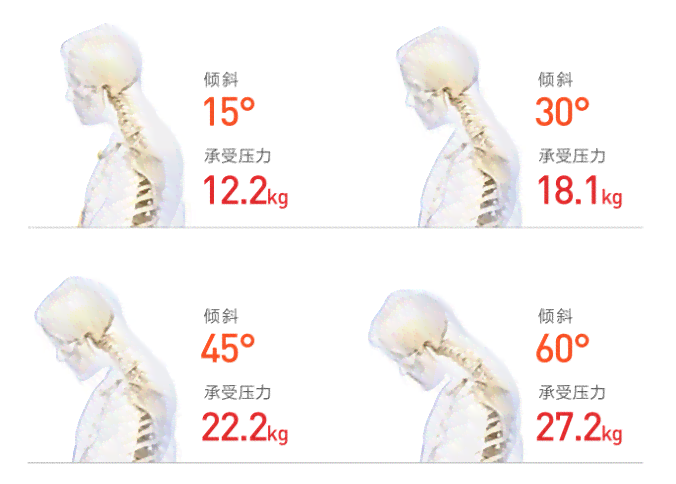 腰椎抬重物损伤预防与复指南：全面解析原因、症状及治疗方法