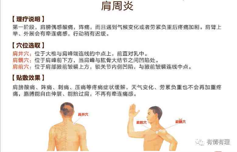 腰椎抬重物损伤预防与复指南：全面解析原因、症状及治疗方法
