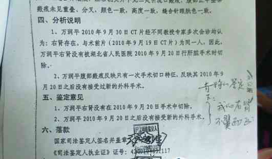 工伤认定：指头植皮手术是否属于工伤补偿范畴