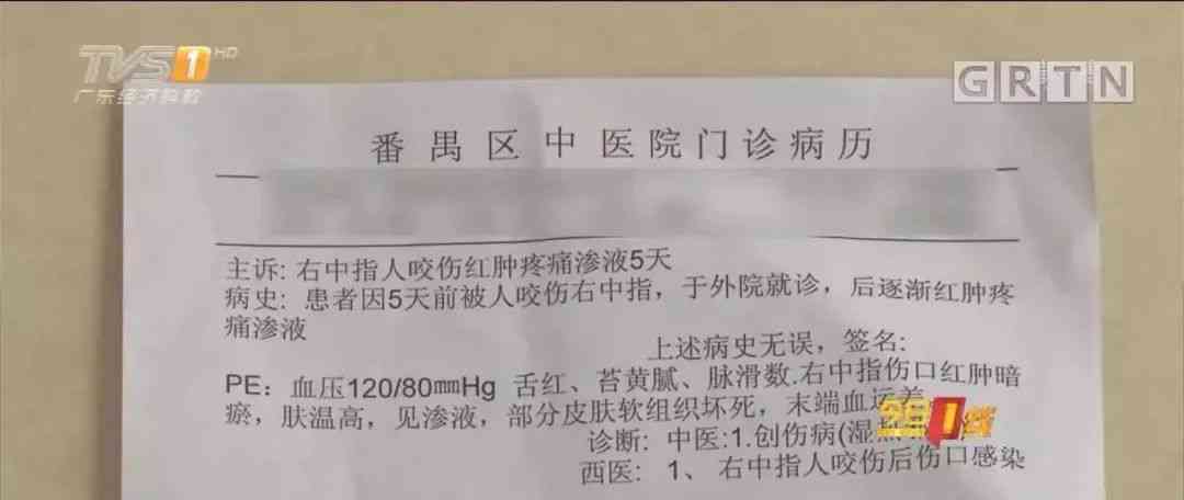 工伤认定：指头植皮手术是否属于工伤补偿范畴