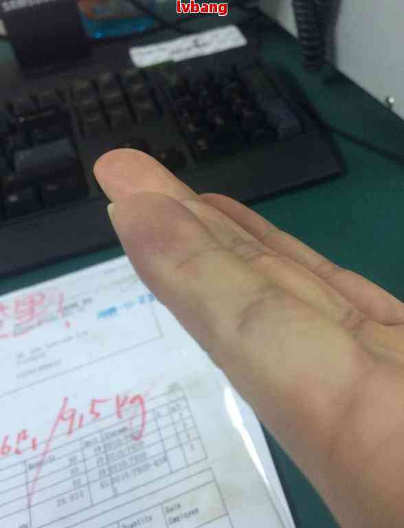 指尖骨裂米粒能认定工伤吗