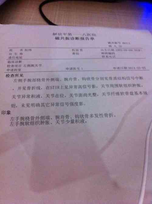 手指尖骨裂工伤等级判定及赔偿标准详解