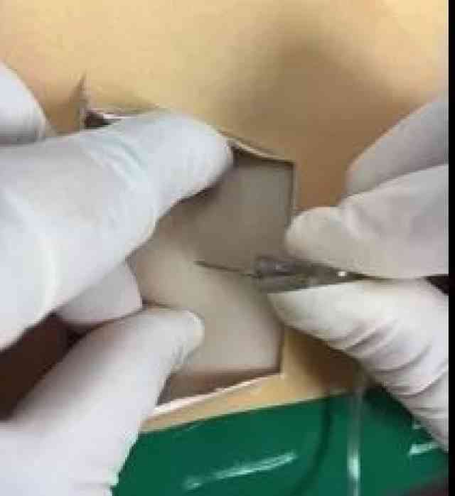 指甲没了能认定工伤吗？指甲损伤工伤赔偿标准是多少？