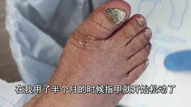 指甲被砸掉能不能认定工伤 指甲被砸掉能不能认定工伤