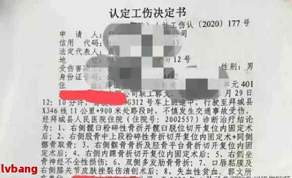 损伤视网膜认定工伤