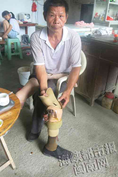 探讨：损坏假肢是否构成侵犯身体权与人格尊严