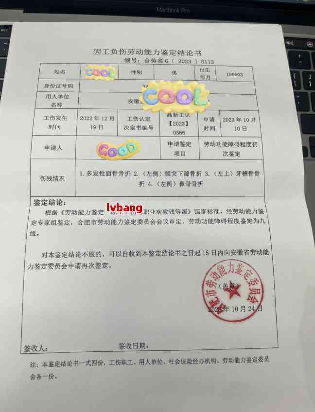 提交认定工伤时有回执吗