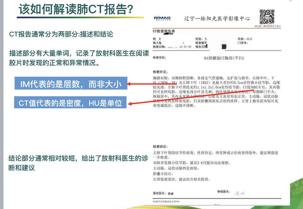 CT报告AIS解析：AI提示低危癌症暗语含义及意义