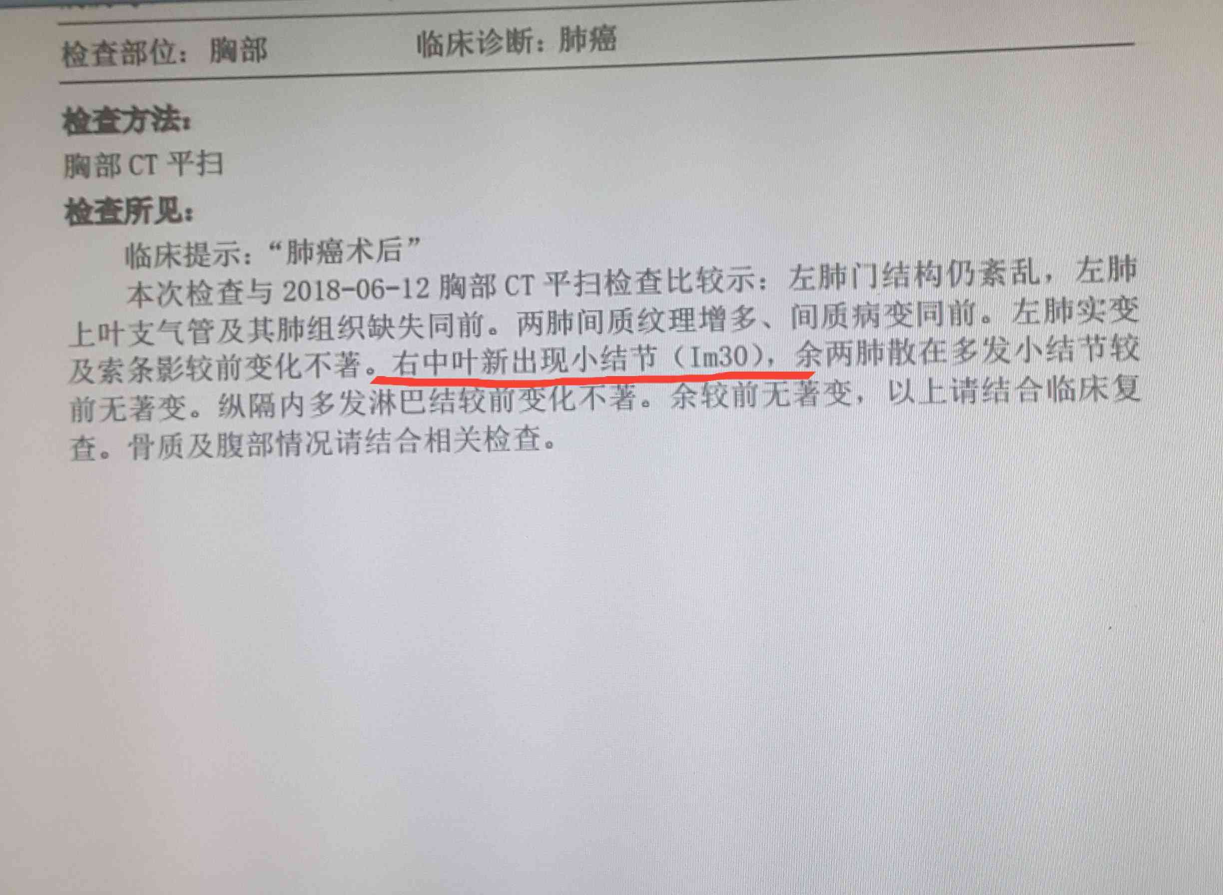 iac诊断：CT扫描结果提示可能性分析报告