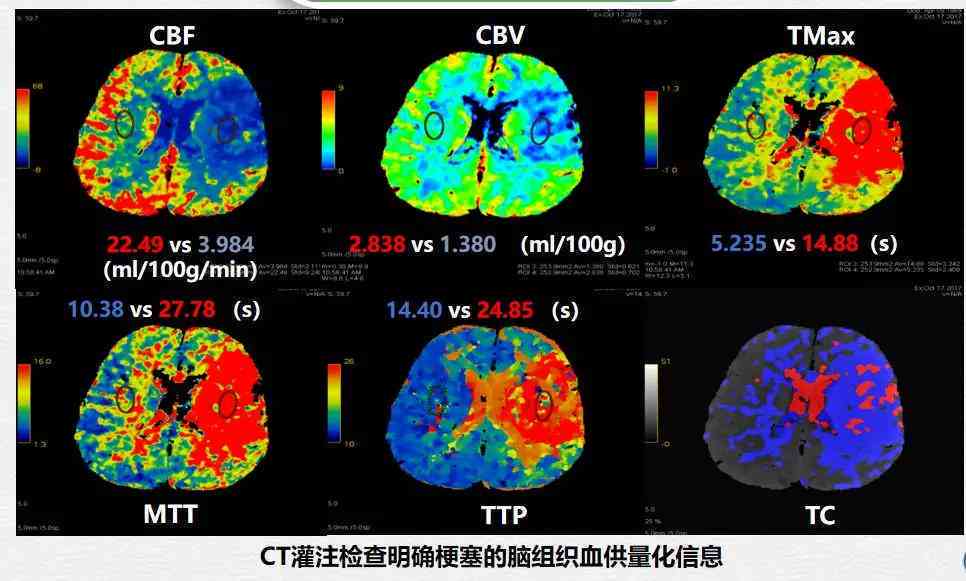 全面解读CT报告：IM成像分析与常见问题详解