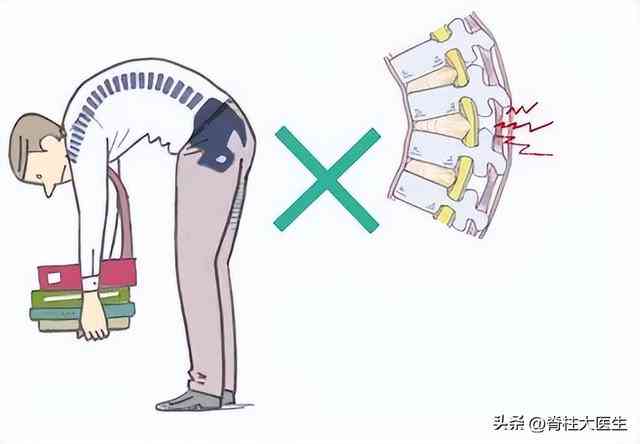 腰部扭伤：一次搬重物引发的疼痛经历