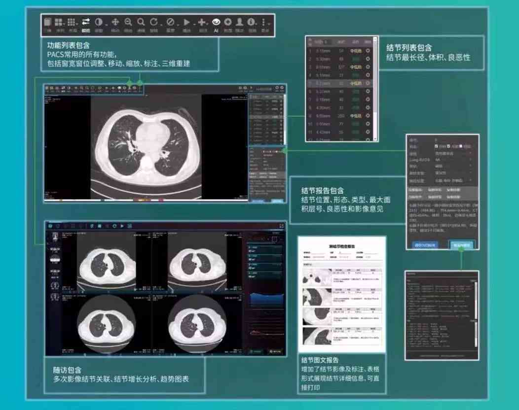 智能AI辅助CT影像诊断报告系统