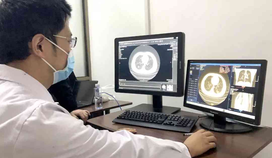 智能AI辅助CT影像诊断报告系统