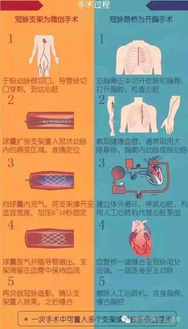 心脏支架手术后潜在风险及应对策略