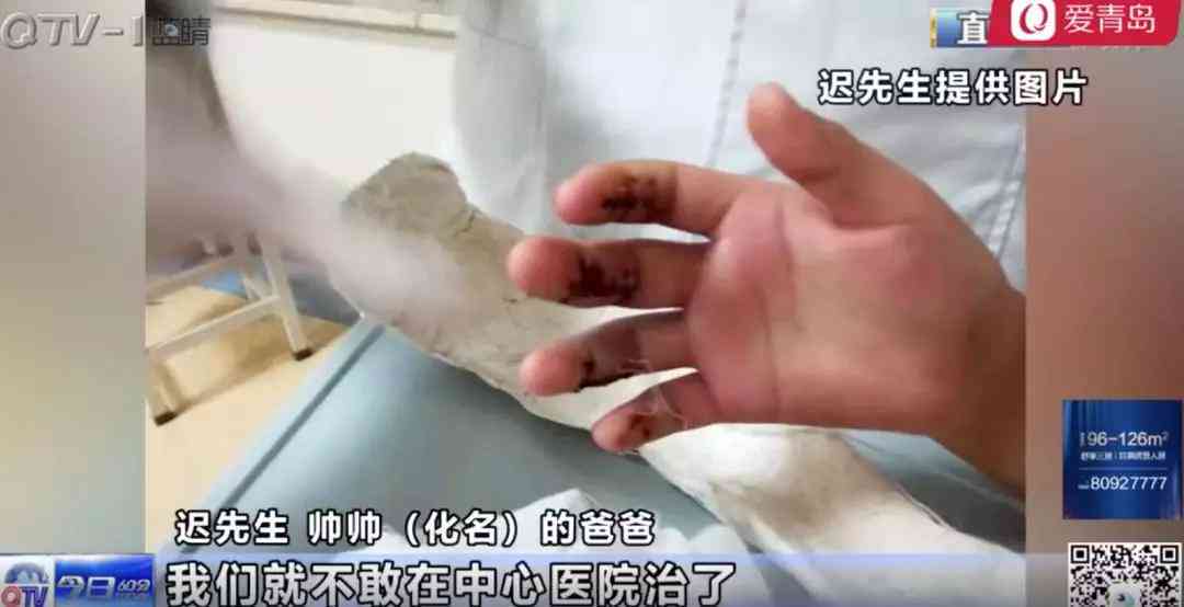 断手指伤残程度鉴定与分级标准解析