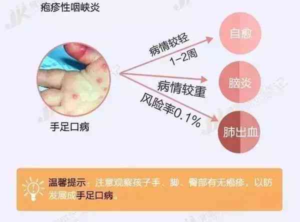 探讨旧疾复发与旧病复发的差异及常见相关问题解析
