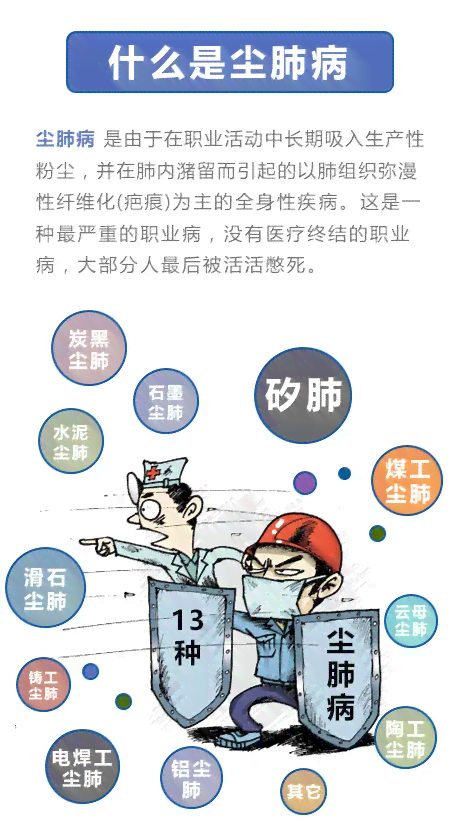 尘肺病工伤认定全解析：早期尘肺能否被认定为工伤及所需条件