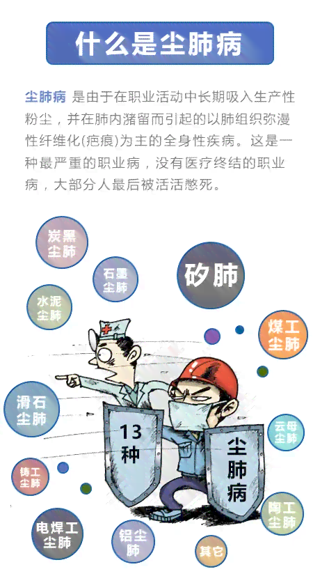 早期尘肺病可以认定工伤吗 早期尘肺病可以认定工伤吗