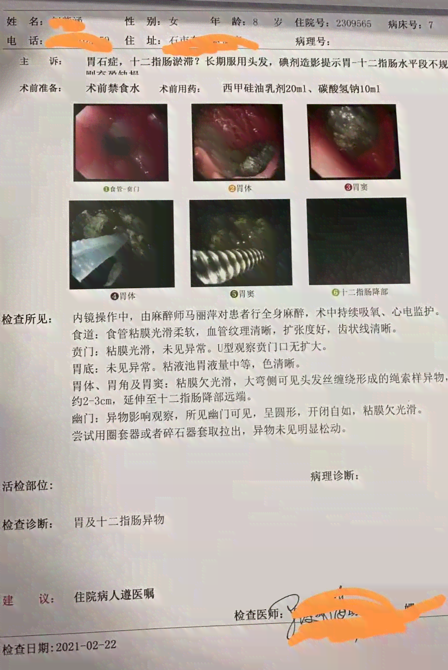胃镜报告中C1C2标记缺失的原因解析