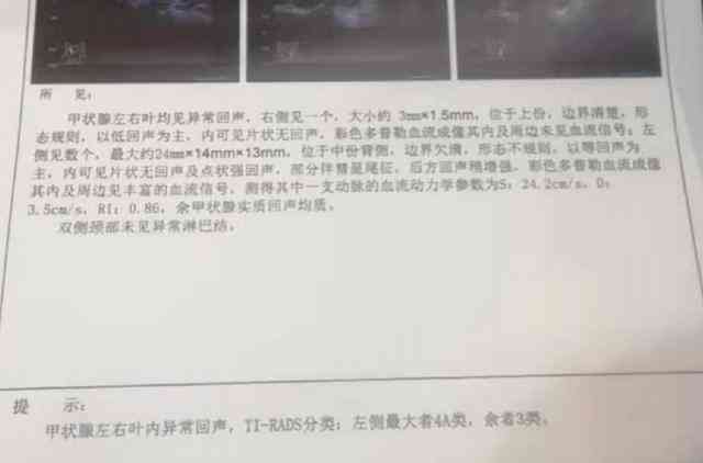 胃镜报告单要求：护士签字、患者同意及医生确认的完整流程指南