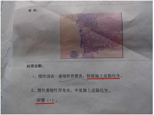 胃镜报告单上有胃粘膜欠光起中间凹陷严重吗：分析症状与潜在健风险