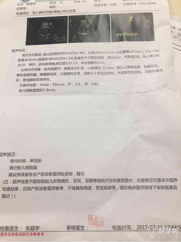 胃镜报告单要求：护士签字、患者同意及医生确认的完整流程指南