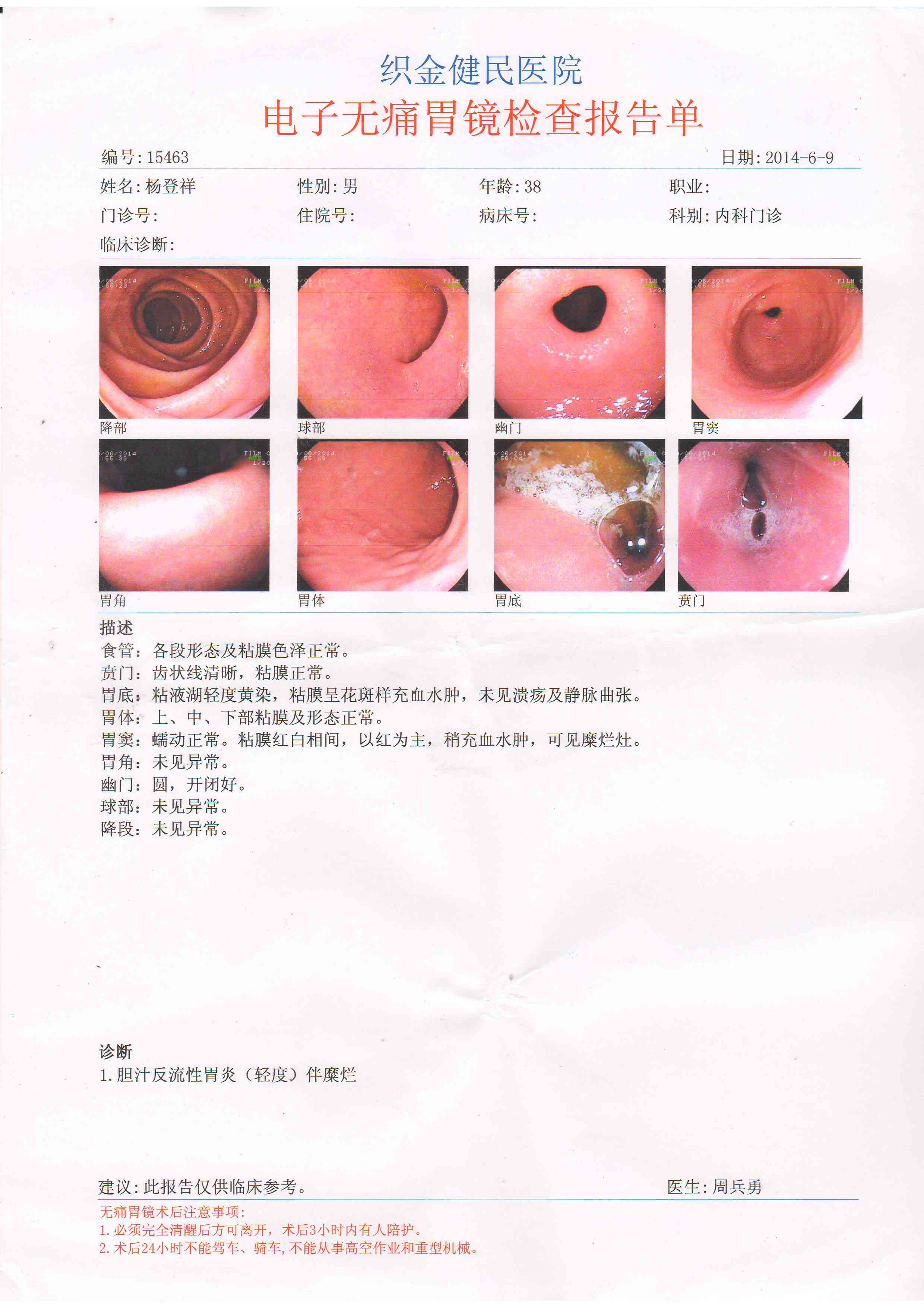 胃镜报告单上有ai