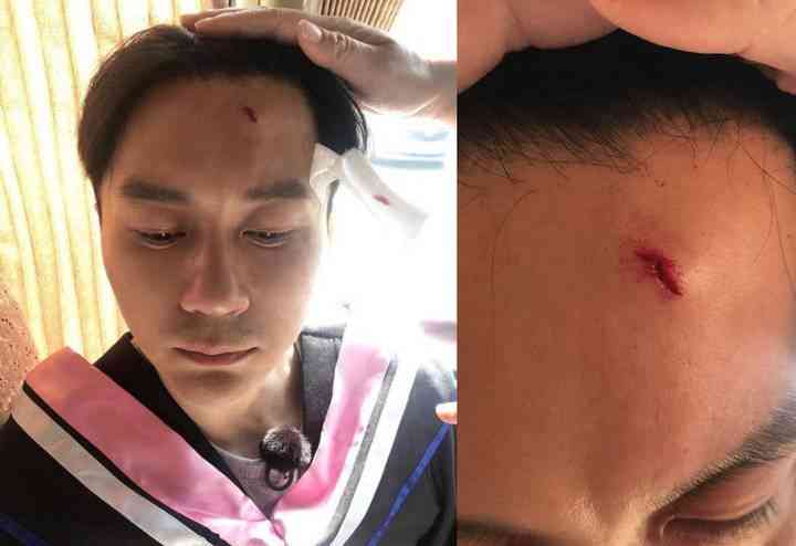 晕厥是否属于意外：探讨其界定与影响