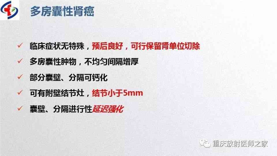 剧情和文案的区别：涵定义、区别在哪，以及剧情类文案撰写要点