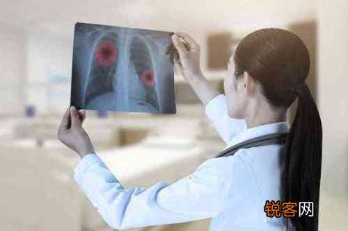 矽肺晚期可以活多久：晚期寿命、治疗方法及临死症状解析