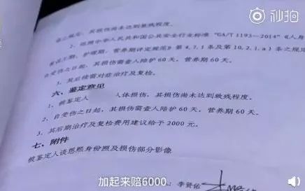 工伤认定标准：小碎骨残留是否属于工伤及如何申请工伤赔偿