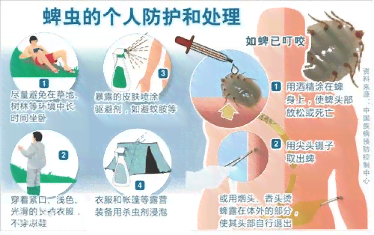探讨蜱虫叮咬：意外还是可预防的风险？
