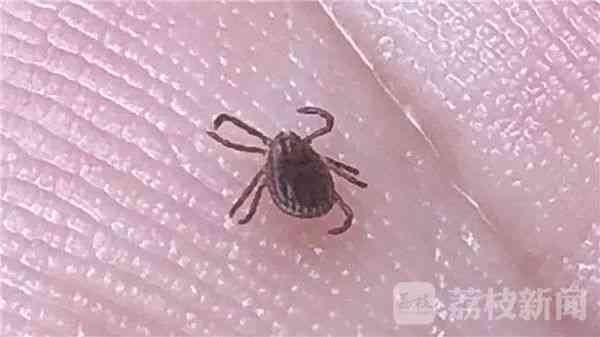 探讨蜱虫叮咬：意外还是可预防的风险？