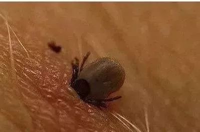 有蜱虫叮咬认定工伤的吗