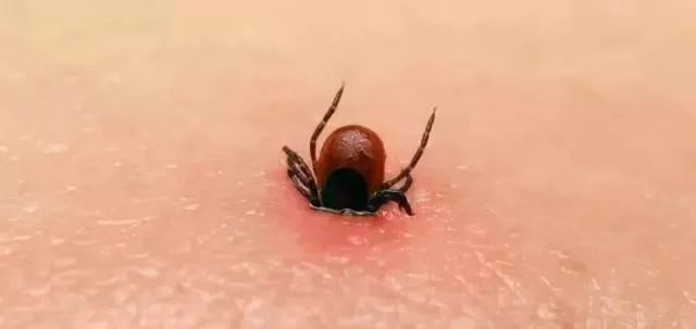 有蜱虫叮咬认定工伤的吗