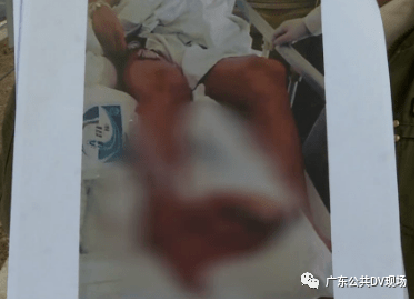 未认定工伤工资怎么发放